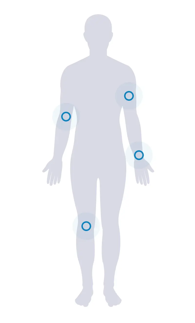 SomaDerm suggested application areas